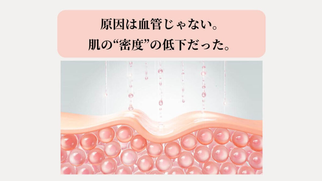 手の血管が浮き出る原因を解説する図。肌密度が高くコラーゲンが豊富な健康な肌の比較イラスト。
