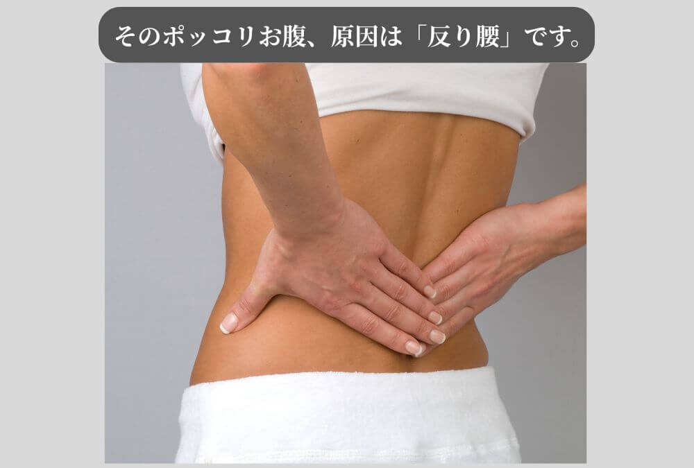 ぽっこりお腹の原因となる「反り腰」の姿勢を解説する画像。