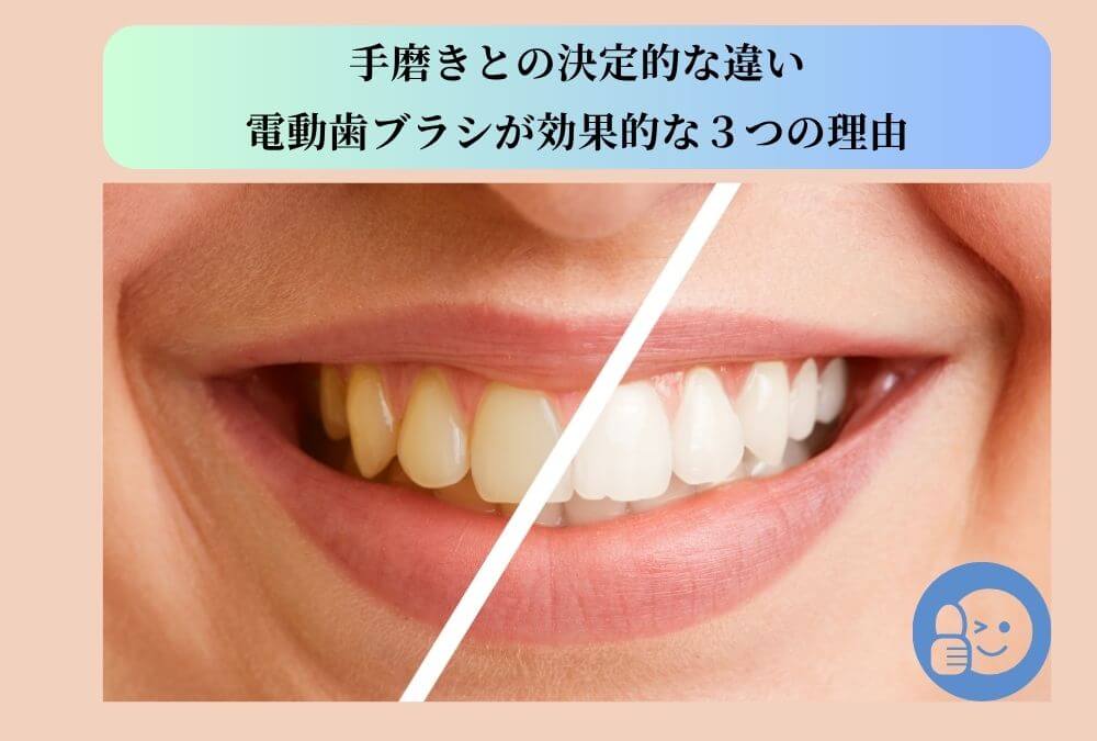 40代のステイン除去に効果的な電動歯ブラシと手磨きの効果を比較した口元の画像。