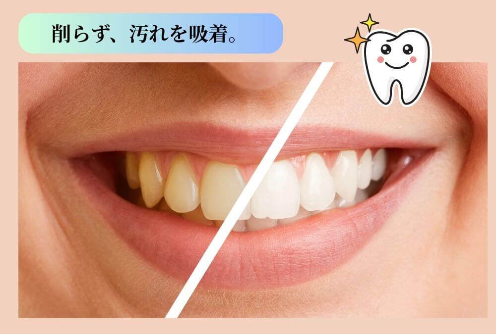 ホワイトニング前とホワイトニング後のビフォーアフター画像